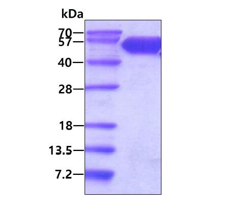3 μg by SDS-PAGE under reducing condition and visualized by coomassie blue stain.